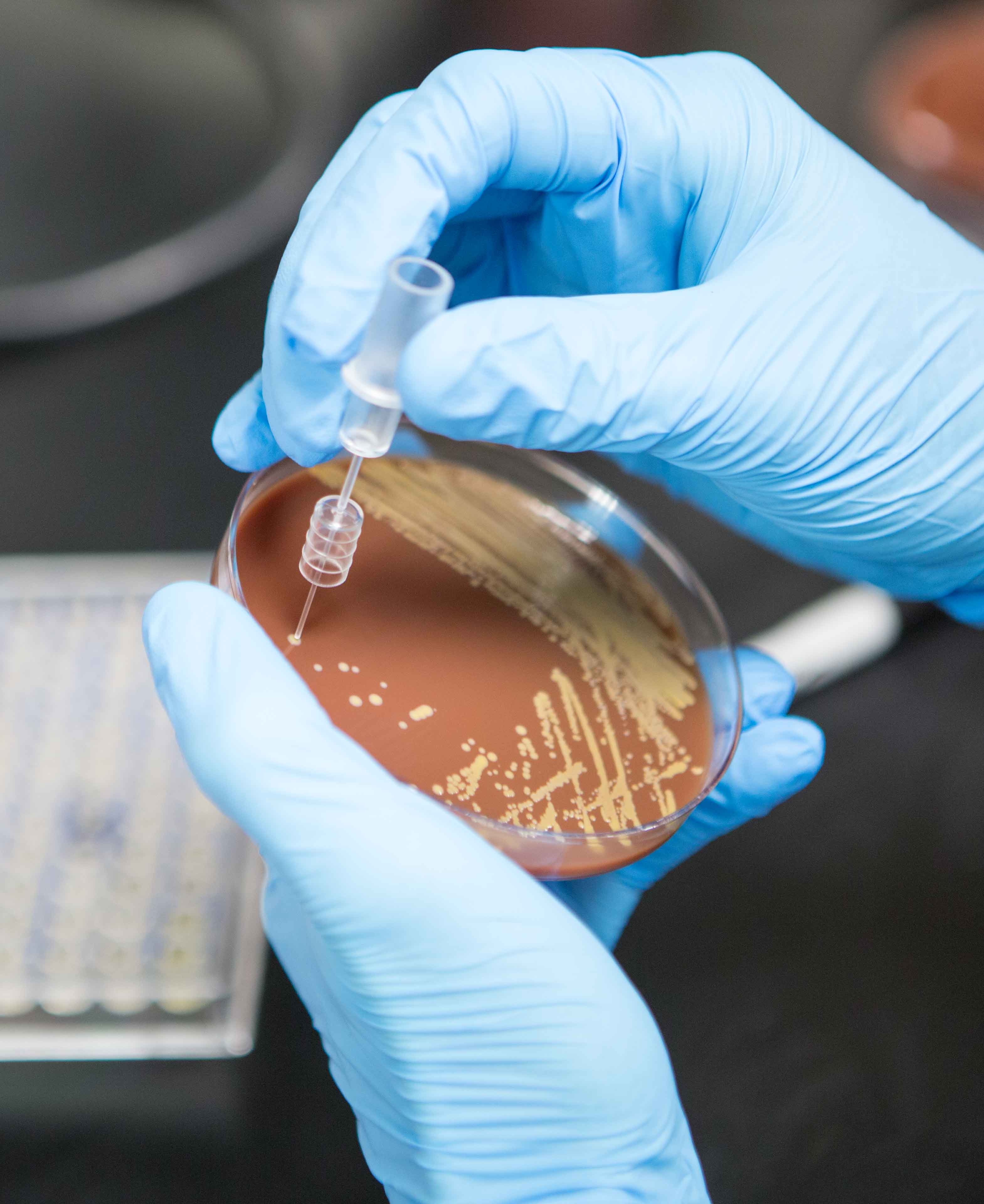 Medical Laboratory Science blood plate